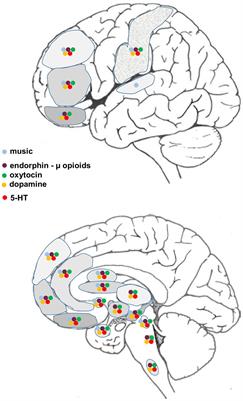 The psychophysiology of music-based interventions and the experience of pain